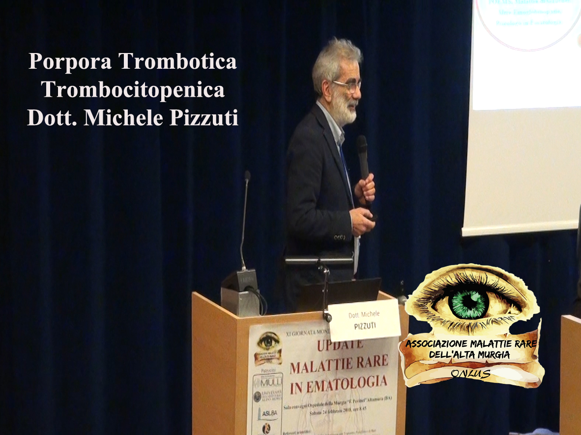 Porpora Trombotica Trombocitopenica Dott. Michele Pizzuti